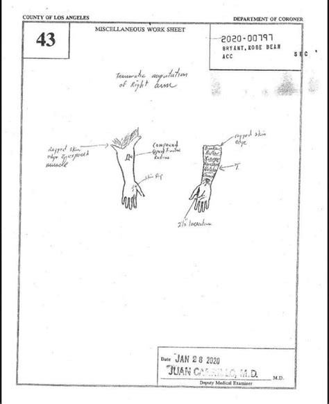 gigi bryants autopsy report|Gianna Bryant 